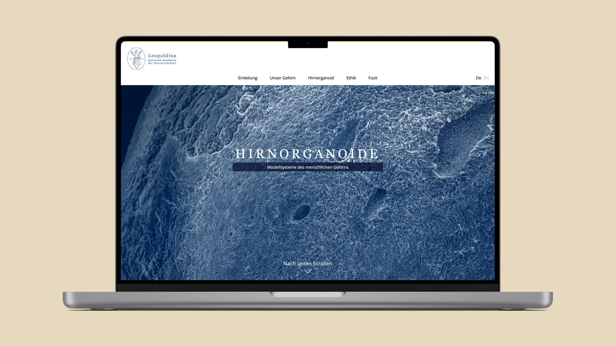 Der Startbildschirm des digitalen Dossiers zum Thema "Hirnorganoide". Im Hintergrund das Bild eines Gehirns.
